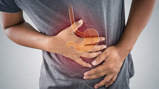 رفلاکس معده و شیوه های درمان آن