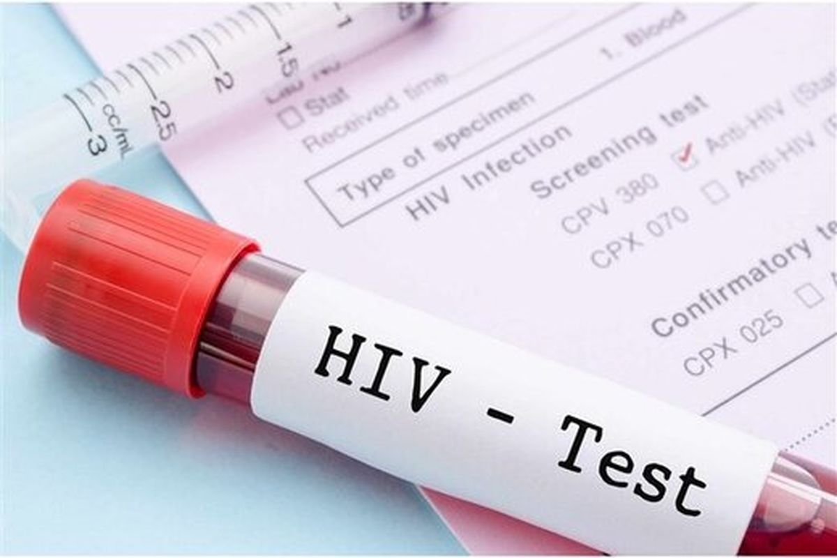 ویروس HIV دیگر نمیتواند پنهان شود